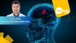 "Maio Cinza: mês de conscientização dos tumores cerebrais", por Doutor Jorge Abissamra Filho