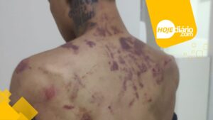 Agressão clínica