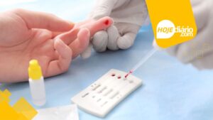 Teste HIV